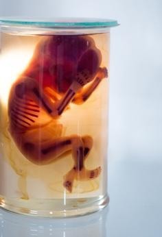 (Photo d'un foetus humain utilisé en laboratoire)